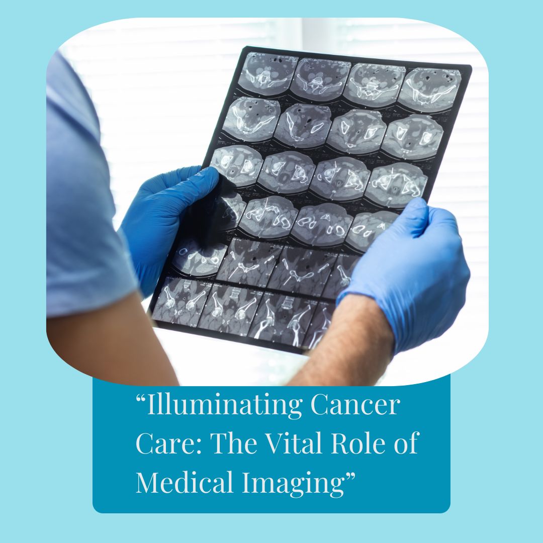 Medical imaging, Cancer diagnosis, Cancer treatment, PET scan, Radiology, Oncology, Nuclear medicine, Positron Emission Tomography (PET), Single-Photon Emission Computed Tomography (SPECT), Gamma camera, DOTATATE scan, DOTANOC scan, Radioisotopes, Radiotracers, Theranostics, Precision oncology, Hybrid imaging, Improved sensitivity & resolution, Faster scanning, Siemens Healthineers, Biograph Vision, Prostate cancer diagnosis, Neuroendocrine tumors, Treatment monitoring, Early cancer detection