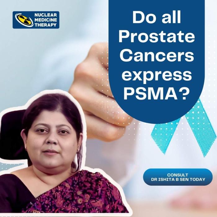 All Prostate Cancers Express PSMA, prostate cancer tereatment, prostate cancer