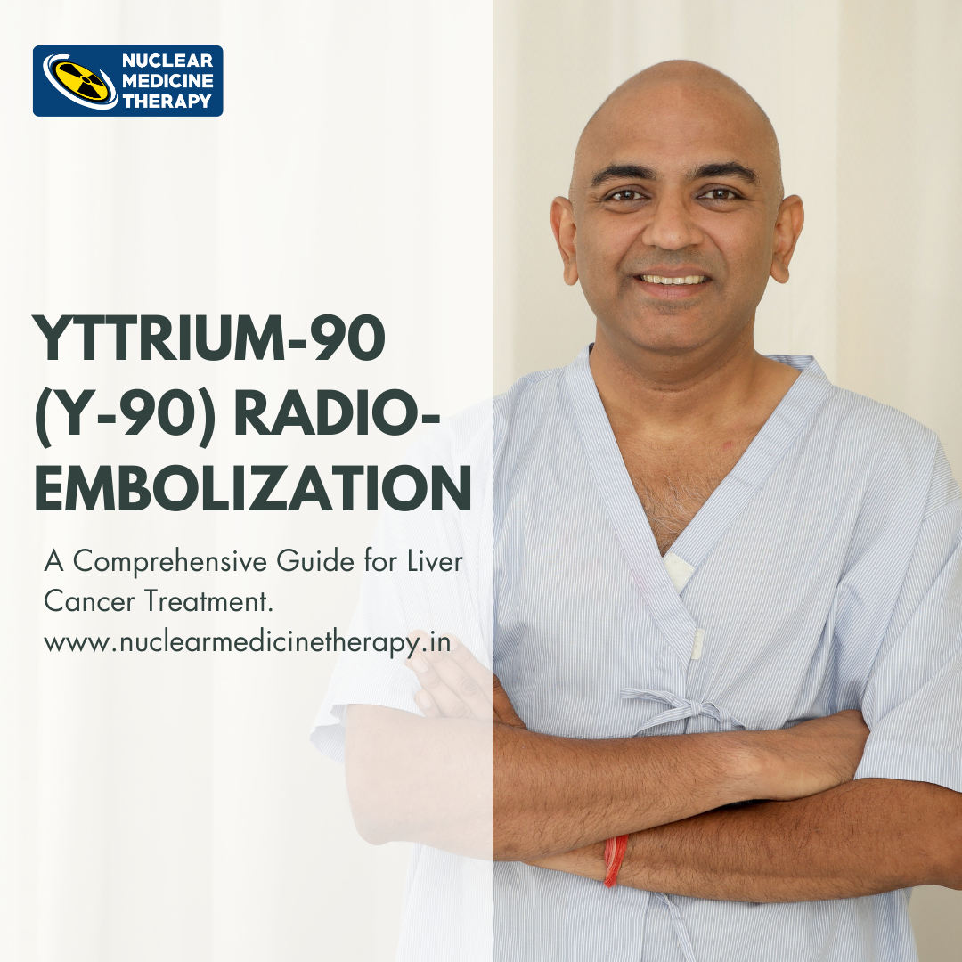 Yttrium-90 treatment for liver cancer, Y-90 radioembolization, Liver cancer treatment options, Unresectable liver cancer therapy, Selective internal radiation therapy (SIRT), Y-90 microspheres liver cancer, Yttrium-90 procedure for hepatocellular carcinoma, Y-90 therapy success rate, Yttrium-90 cost India,  Advanced liver cancer radiation treatment, Yttrium-90 survival rate liver cancer, Side effects of Y-90 treatment, Y-90 radioembolization vs TACE,  Best treatment for liver metastases, Yttrium-90 downstaging liver cancer
