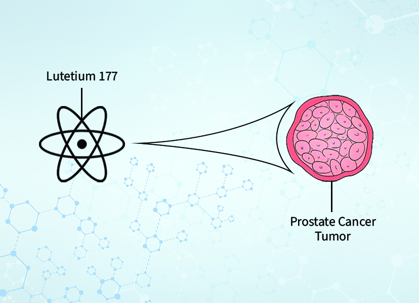 Find Lutetium Lu Psma Therapy For Prostate Cancer In India Nuclear Medicine Therapy