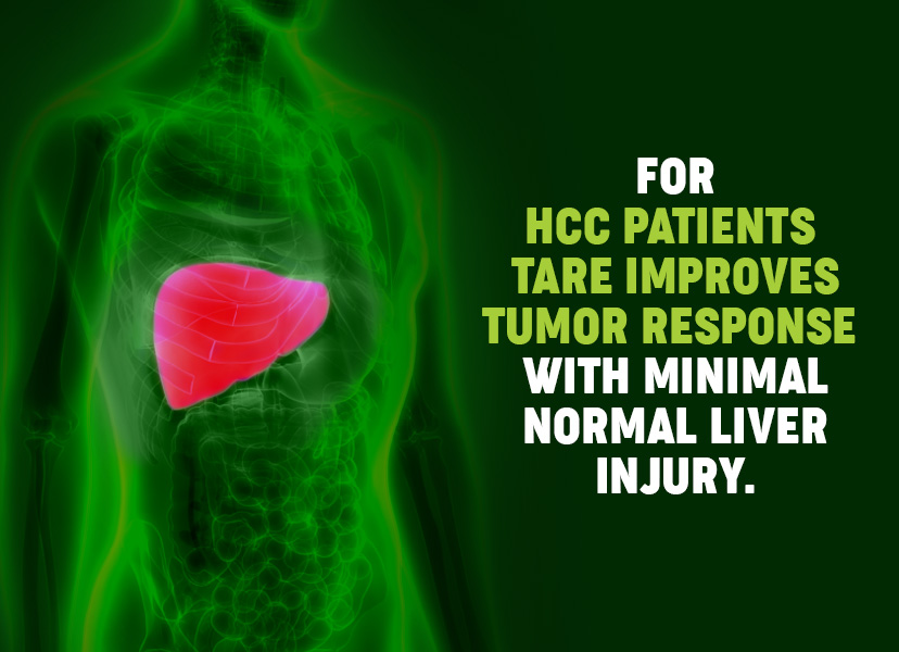 TARE vs TACE for Hepatocellular Carcinoma and NET patients