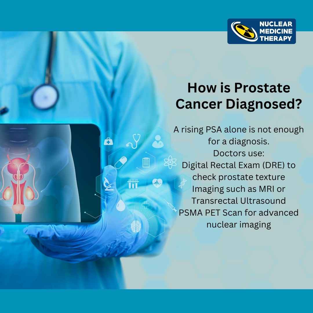 how is prostate cancer diagnosed, psa level, Raised psa what does it means, raised PSA value