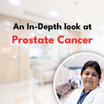 An In-Depth look at Prostate Cancer