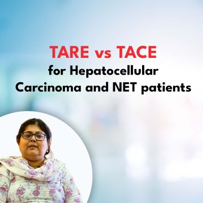 TARE vs TACE for Hepatocellular Carcinoma and NET patients