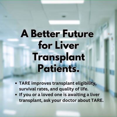 TARE for liver cancer, Transarterial radioembolization liver transplant, Yttrium-90 treatment for HCC, Liver cancer downstaging for transplant, TARE vs TACE for hepatocellular carcinoma, Bridging therapy for liver transplant, Radioembolization survival rates post-transplant, Cost-effectiveness of TARE for liver cancer, Y-90 therapy for liver cancer patients, HCC treatment before liver transplantation, Dr. Ishita B Sen