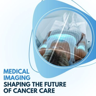 Medical Imaging: Shedding Light on Cancer Diagnosis and Treatment