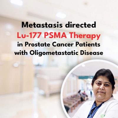 Metastasis directed Lu-177 PSMA Therapy in Prostate Cancer Patients with Oligometastatic Disease