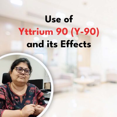 Use of Yttrium 90 (Y-90) and its effects