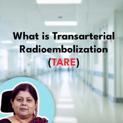 What is Transarterial Radioembolization (TARE)